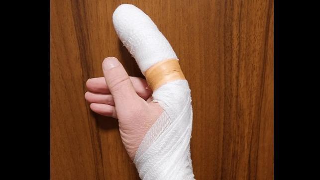 Break Your Finger Psyker