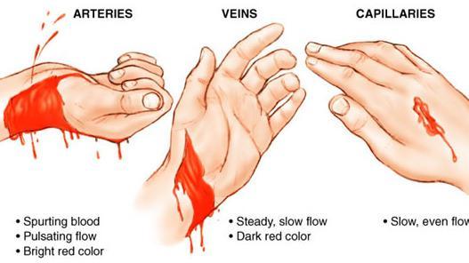 BleedMAXXING